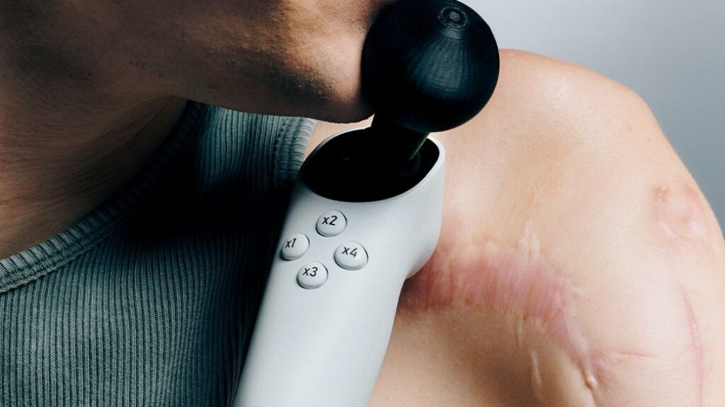 Xbox launches Wii Nunchuk-style Adaptive Joystick