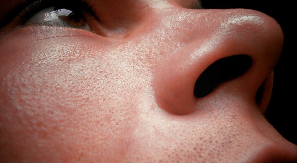 Do You Want Great Skin?