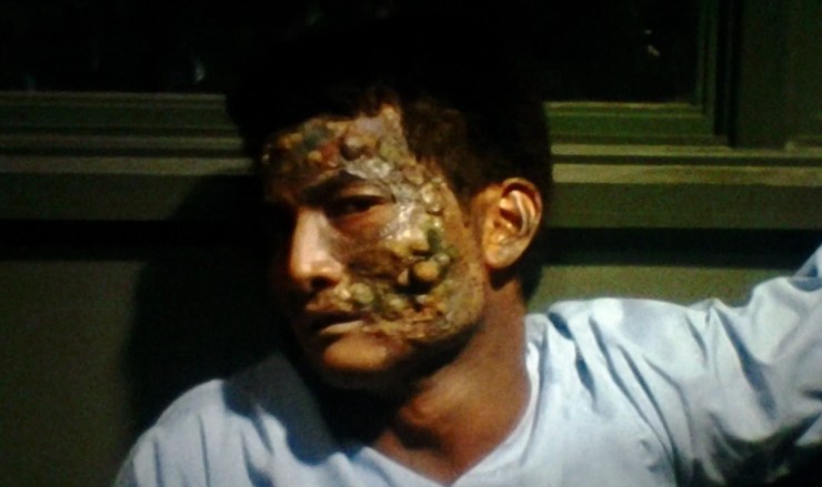 10 Gruesome Body Horror Movies You Maybe Haven’t Seen